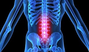 osteocondroza coloanei vertebrale la adulți